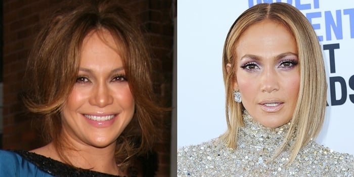 Jennifer Lopez Denies Plastic Surgery: Face Before and After