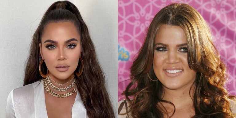 Did Khloé Kardashian Get A Nose Job? Face Before And After