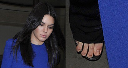 Kendall Jenner Reveals Weird Feet In Sexy Open Back Solace London Top