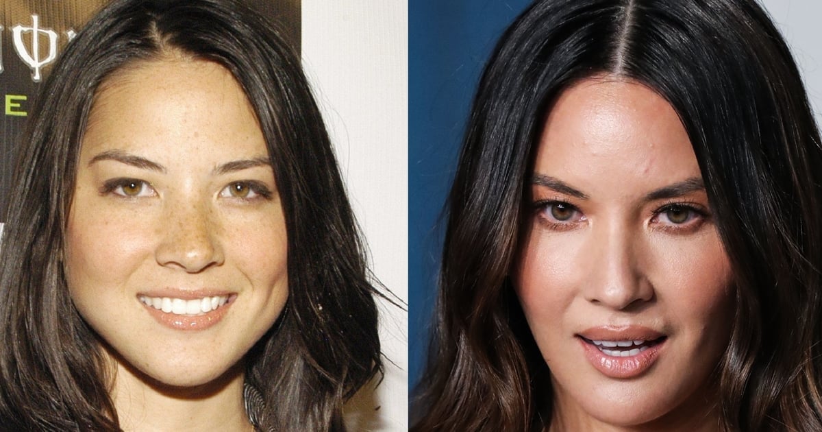 Did Olivia Munn Have Plastic Surgery Lips Before And After