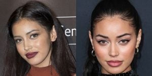 Cindy Kimberly Denies Nose Job: Face Before/After Plastic Surgery