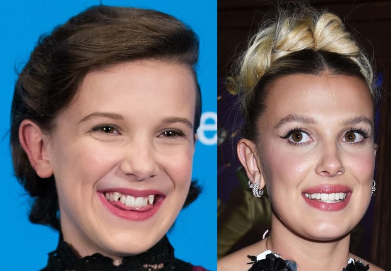 Millie Bobby Brown Flashes Fixed Teeth and Makes Funny Faces