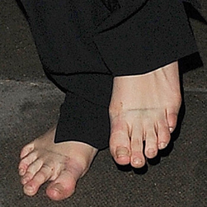 30 Celebs With Ugly Feet: Crusty Toes and Nasty Toenails - BSS news