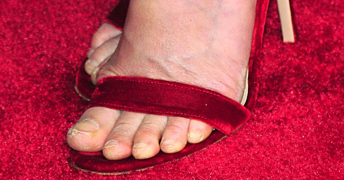 15 Of The Ugliest Celebrity Feet 15 Of The Ugliest Ce - vrogue.co