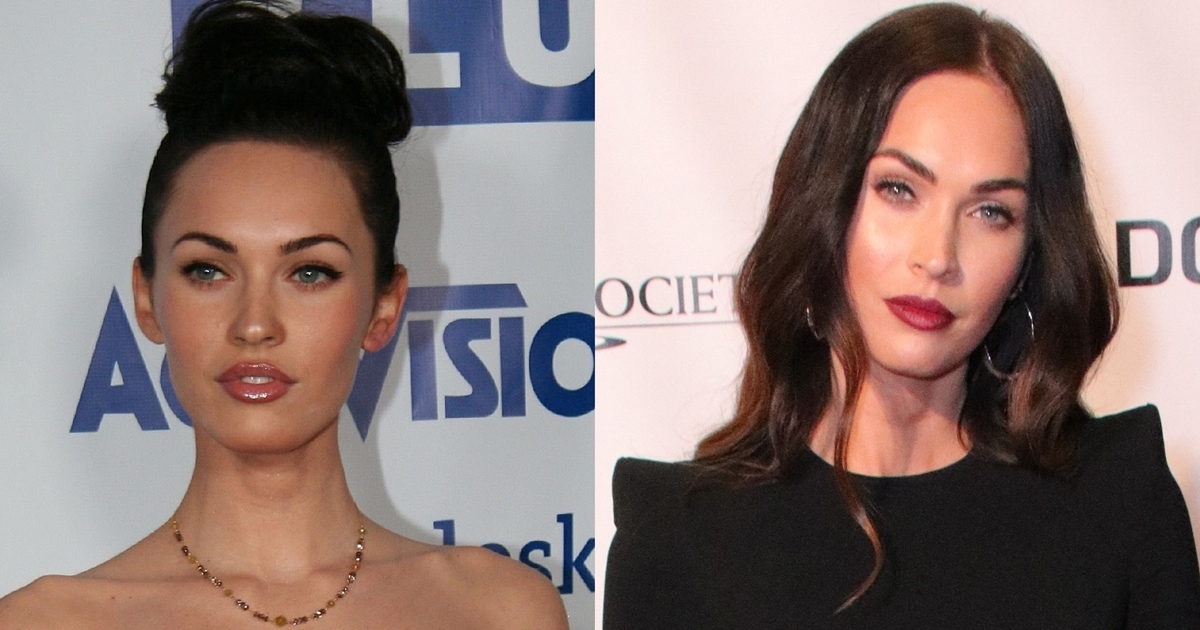 Megan Fox Before And After Plastic Surgery And Net Worth