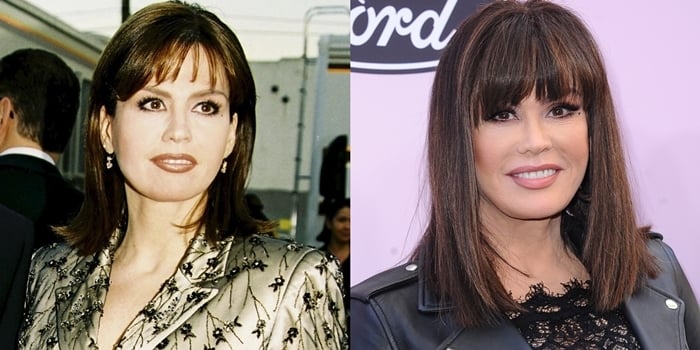 Marie Osmond Breast Implant Marie Osmond Plastic Surgery | Hot Sex Picture