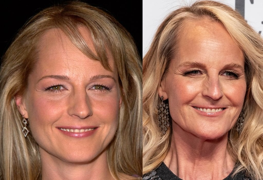 Did Helen Hunt Get Plastic Surgery? Analyzing Her Timeless Look