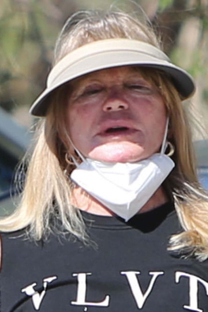 Goldie Hawn's Plastic Surgery Transformation Before and After Photos