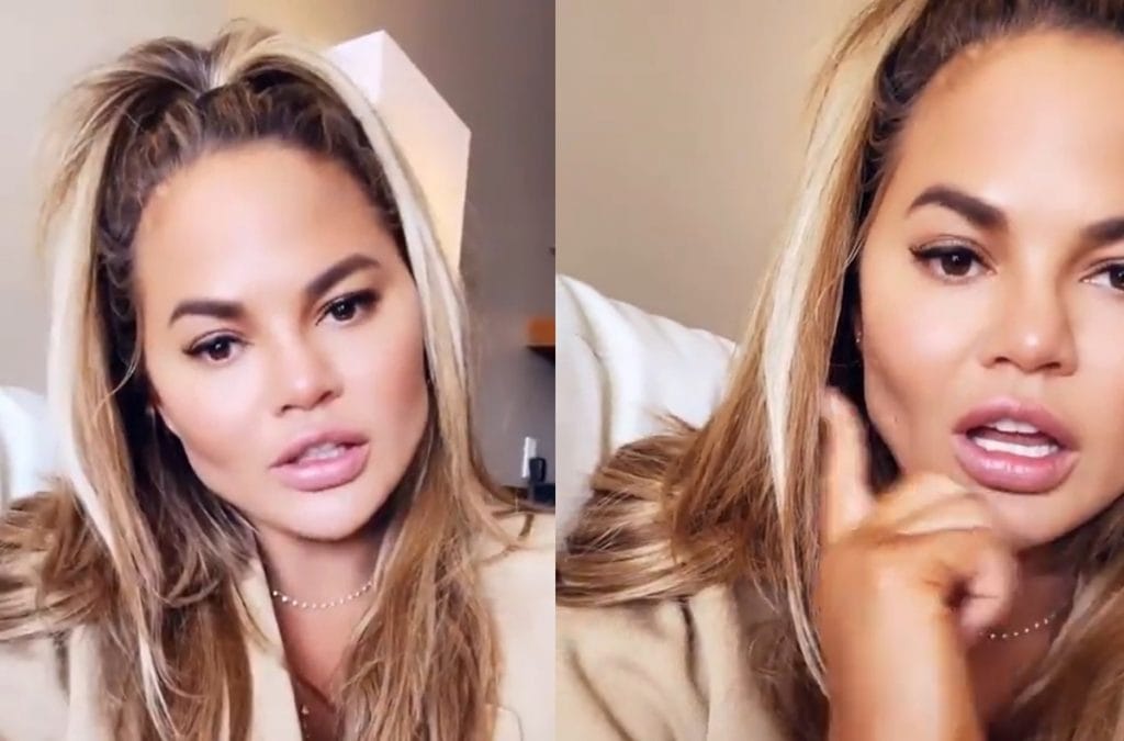Chrissy Teigen Celebrates Sobriety And New Look After Cheek Surgery 