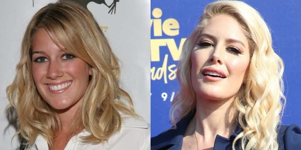 Heidi Montag's Plastic Surgery A Look at Her Before and After Photos