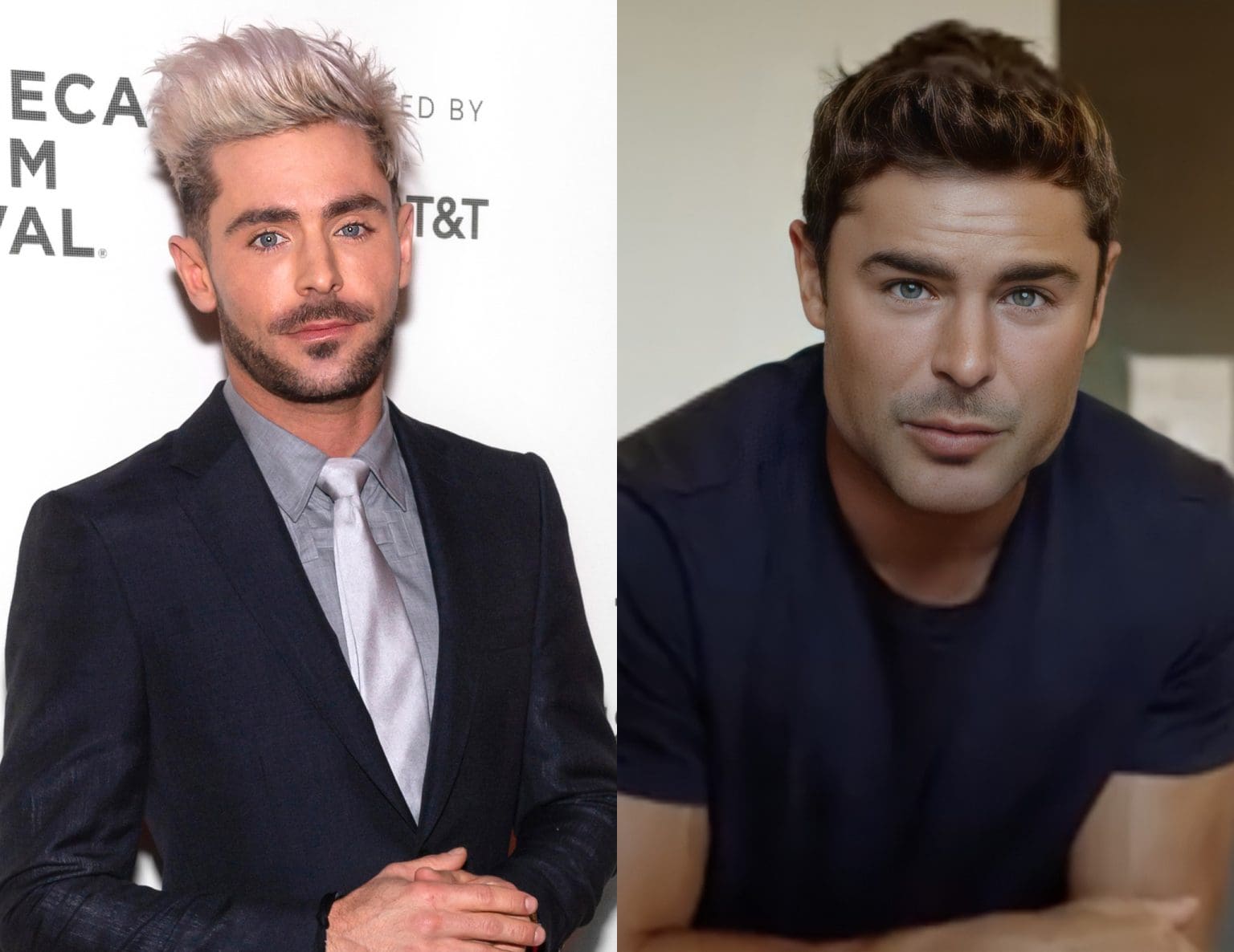 Zac Efron's Jaw Transformation: The Truth Behind His New Look
