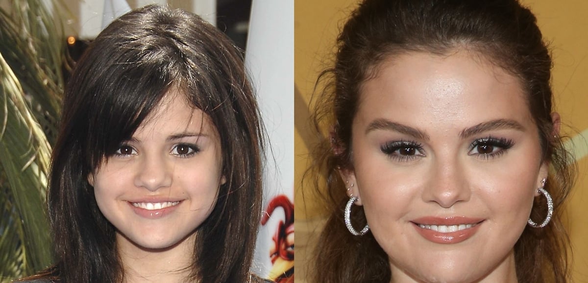 Selena Gomez Plastic Surgery Boob Job Nose Job Botox My Xxx Hot Girl