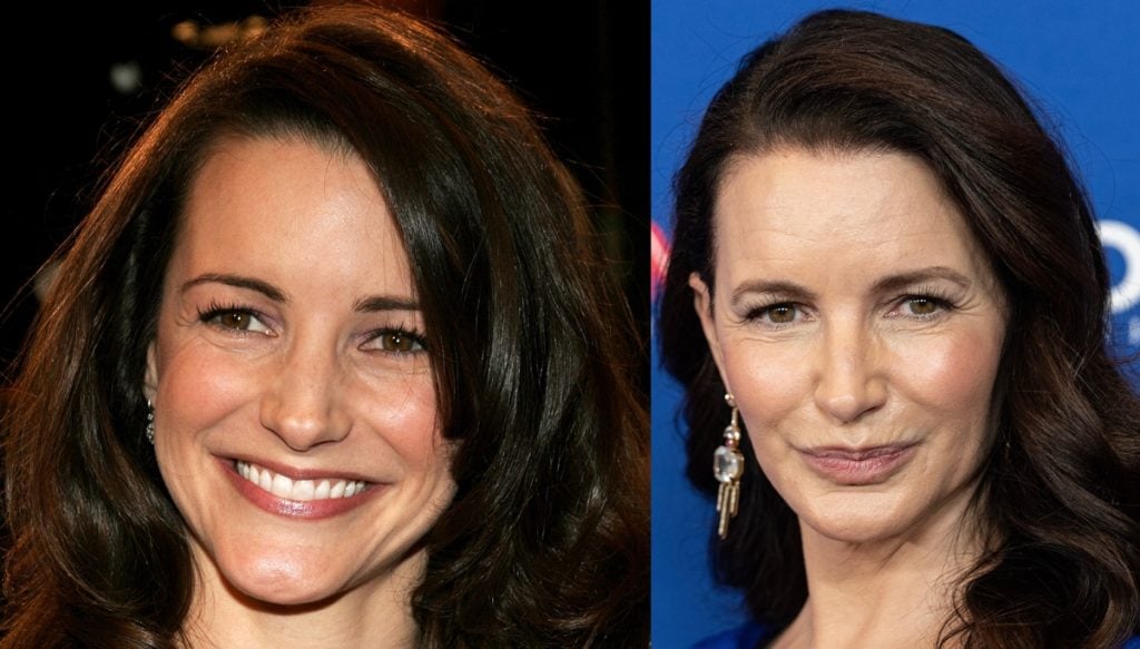Kristin Davis Plastic Surgery Rumors Face Before And After